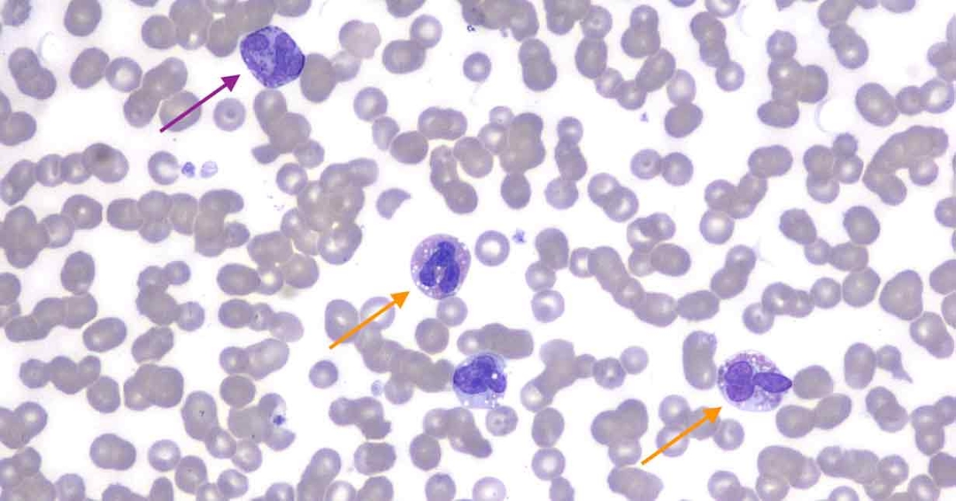 Clinical case of a dog with eosinophilia and basophilia