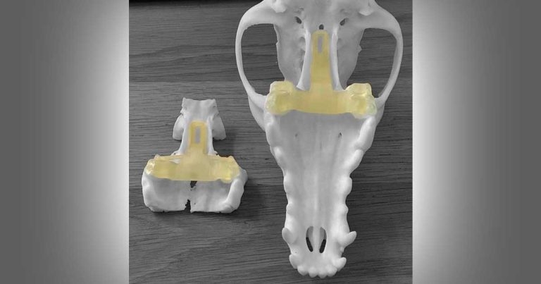 Bristol practice unveils radical 3D printing guide to aid Cushing’s disease surgery